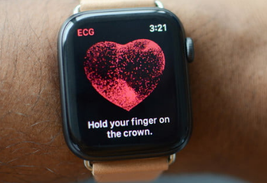 苹果专利表明Apple Watch表带可能具有内置健身指标