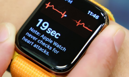 苹果Apple Watch Series 6手表可能配备血氧监测传感器