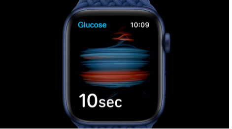 新的苹果传闻包括苹果手表血糖传感器可折叠iPhone等