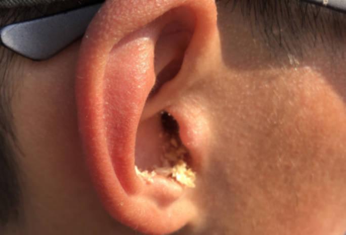 如何维持耳屎与听力动态平衡？