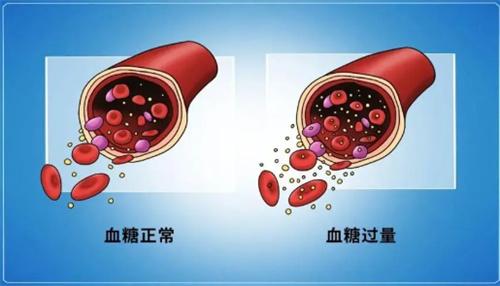 别大意身上有这几种表现你可能得了严重的糖尿病并发症