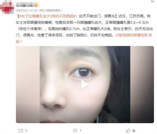 女子左眼瞳孔变大2倍找不到病因：日间光照引发畏光症状