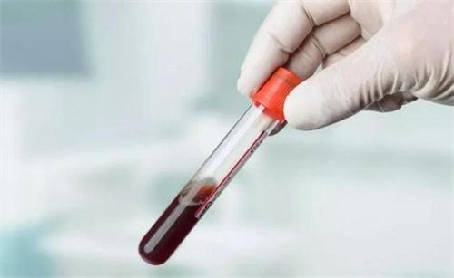 为什么进医院就要抽血 医生揭秘：抽出来的血 有什么作用