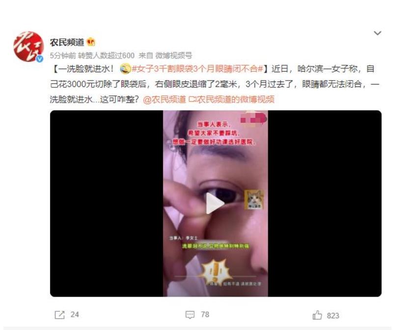 眼袋手术后3个月眼睛闭不合，女子苦恼洗脸进水该如何解决？