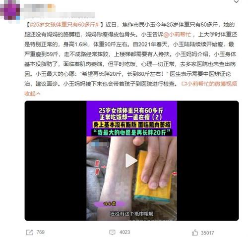 焦作25岁女孩体重只有60多斤，求助中医辨证论治