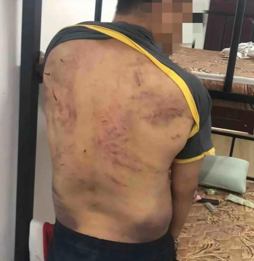 缅甸诈骗陷阱：逃离困境的故事