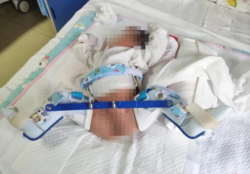 天津医院剖腹产事故：孩子大腿骨折，家属要求高额赔偿
