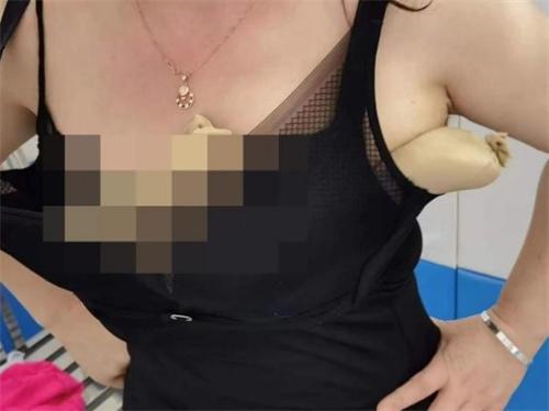 一名女子用丝袜包5条活蛇藏胸部入境被抓