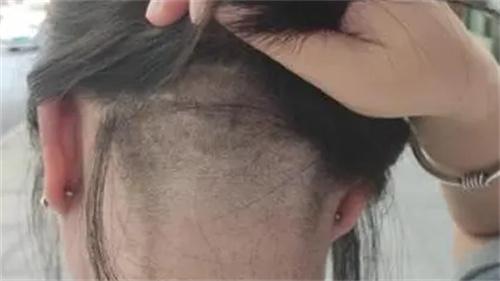 女子后脑勺头发被理发师剃掉一半 事后没有任何赔偿