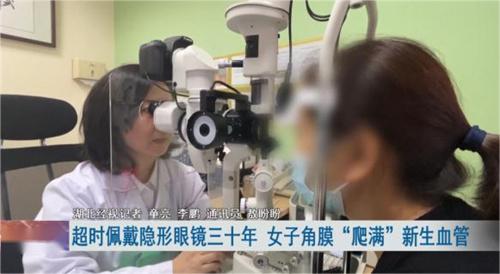 女子戴隐形眼镜30年双眼角膜长满血管