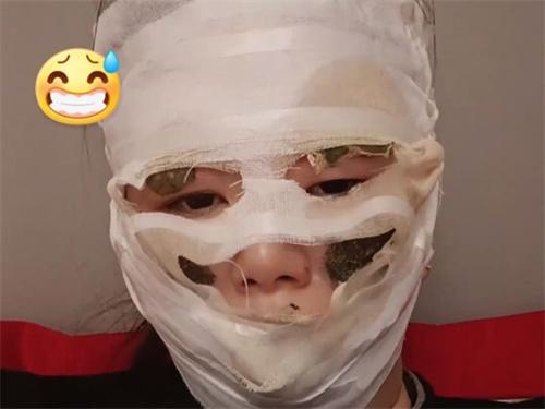 新娘结婚当天被喷雾彩带烫伤 当回新娘脸差点被毁容