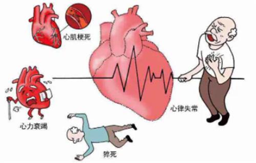 心肌缺血的危害（关于心肌缺血的简介）